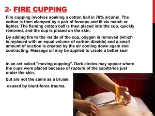 2- FIRE CUPPING
Fire cupping involves soaking a cotton ball in 70% alcohol. The
cotton is then clamped by a pair of forceps and lit via match or
lighter. The flaming cotton ball is then placed into the cup, quickly
removed, and the cup is placed on the skin.
By adding fire to the inside of the cup, oxygen is removed (which
is replaced with an equal volume of carbon dioxide) and a small
amount of suction is created by the air cooling down again and
contracting. Massage oil may be applied to create a better seal
in an act called "moving cupping". Dark circles may appear where
the cups were placed because of rupture of the capillaries just
under the skin,
but are not the same as a bruise
caused by blunt-force trauma.
 