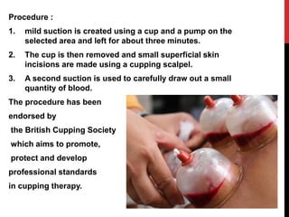 Procedure :
1. mild suction is created using a cup and a pump on the
selected area and left for about three minutes.
2. The cup is then removed and small superficial skin
incisions are made using a cupping scalpel.
3. A second suction is used to carefully draw out a small
quantity of blood.
The procedure has been
endorsed by
the British Cupping Society
which aims to promote,
protect and develop
professional standards
in cupping therapy.
 