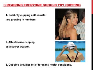 3 REASONS EVERYONE SHOULD TRY CUPPING
1. Celebrity cupping enthusiasts
are growing in numbers.
2. Athletes use cupping
as a secret weapon.
3. Cupping provides relief for many health conditions.
 