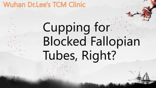 Cupping for
Blocked Fallopian
Tubes, Right?
 