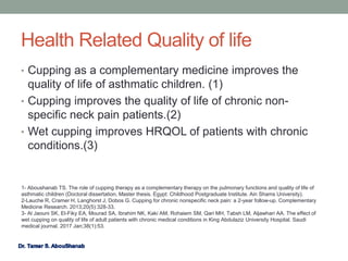 Health Related Quality of life
• Cupping as a complementary medicine improves the
quality of life of asthmatic children. (1)
• Cupping improves the quality of life of chronic non-
specific neck pain patients.(2)
• Wet cupping improves HRQOL of patients with chronic
conditions.(3)
1- Aboushanab TS. The role of cupping therapy as a complementary therapy on the pulmonary functions and quality of life of
asthmatic children (Doctoral dissertation, Master thesis. Egypt: Childhood Postgraduate Institute. Ain Shams University).
2-Lauche R, Cramer H, Langhorst J, Dobos G. Cupping for chronic nonspecific neck pain: a 2-year follow-up. Complementary
Medicine Research. 2013;20(5):328-33.
3- Al Jaouni SK, El-Fiky EA, Mourad SA, Ibrahim NK, Kaki AM, Rohaiem SM, Qari MH, Tabsh LM, Aljawhari AA. The effect of
wet cupping on quality of life of adult patients with chronic medical conditions in King Abdulaziz University Hospital. Saudi
medical journal. 2017 Jan;38(1):53.
 