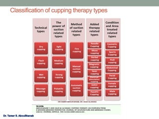 Classification of cupping therapy types
 