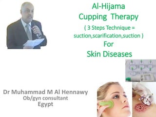 Al-Hijama
Cupping Therapy
( 3 Steps Technique =
suction,scarification,suction )
For
Skin Diseases
Dr Muhammad M Al Hennawy
Ob/gyn consultant
Egypt
 