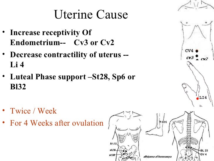 Cupping therapy / Hijama & Infertility