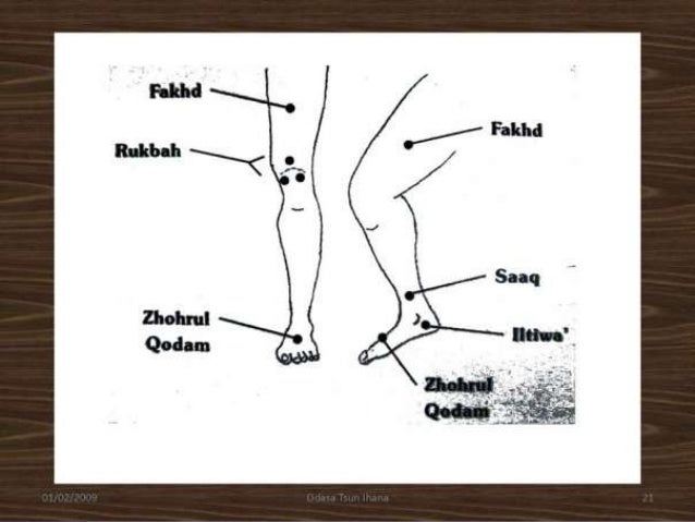 Cupping therapy or bekam or hijamah