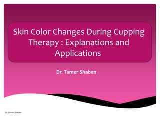 Skin Color Changes During Cupping
Therapy : Explanations and
Applications
Dr. Tamer Shaban
Dr. Tamer Shaban
 