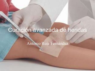 Curación avanzada de heridas
Antonio Ruiz Fernández

 