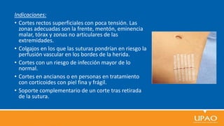 Indicaciones:
• Cortes rectos superficiales con poca tensión. Las
zonas adecuadas son la frente, mentón, eminencia
malar, tórax y zonas no articulares de las
extremidades.
• Colgajos en los que las suturas pondrían en riesgo la
perfusión vascular en los bordes de la herida.
• Cortes con un riesgo de infección mayor de lo
normal.
• Cortes en ancianos o en personas en tratamiento
con corticoides con piel fina y frágil.
• Soporte complementario de un corte tras retirada
de la sutura.
 