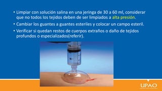 • Limpiar con solución salina en una jeringa de 30 a 60 ml, considerar
que no todos los tejidos deben de ser limpiados a alta presión.
• Cambiar los guantes a guantes esteriles y colocar un campo esteril.
• Verificar si quedan restos de cuerpos extraños o daño de tejidos
profundos o especializados(referir).
 