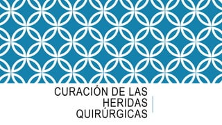 CURACIÓN DE LAS
HERIDAS
QUIRÚRGICAS
 