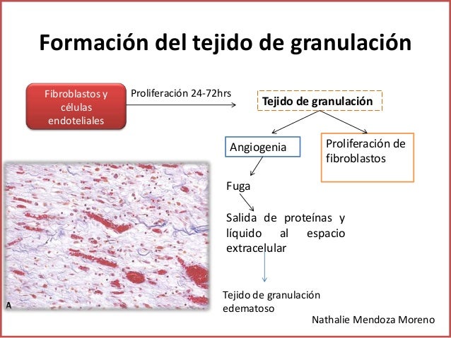 Curación mediante reparación, formación de cicatrices y fibrosis