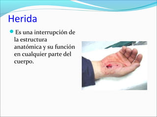 Herida 
Es una interrupción de 
la estructura 
anatómica y su función 
en cualquier parte del 
cuerpo. 
 