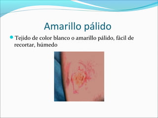 Amarillo pálido 
Tejido de color blanco o amarillo pálido, fácil de 
recortar, húmedo 
 