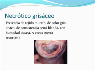 Necrótico grisáceo 
Presencia de tejido muerto, de color gris 
opaco, de consistencia semi-blanda, con 
humedad escasa. A veces cuesta 
recortarlo 
 
