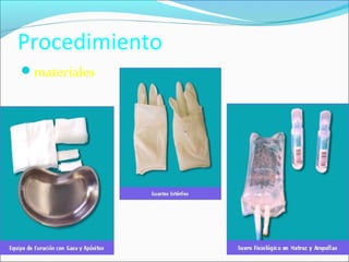Procedimiento 
materiales 
 