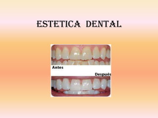 ESTETICA DENTAL
 