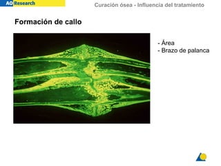 Curación ósea - Influencia del tratamiento
Formación de callo
- Área
- Brazo de palanca
 