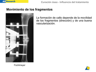 Curación ósea - Influencia del tratamiento
La formación de callo depende de la movilidad
de los fragmentos (dirección) y de una buena
vascularización.
Movimiento de los fragmentos
Füchtmeyer
 