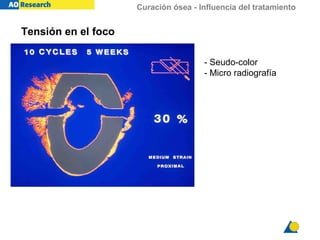 Curación ósea - Influencia del tratamiento
Tensión en el foco
- Seudo-color
- Micro radiografía
 