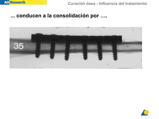 Curación ósea - Influencia del tratamiento
... conducen a la consolidación por ….
 