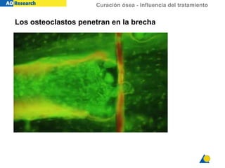 Curación ósea - Influencia del tratamiento
Los osteoclastos penetran en la brecha
 
