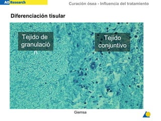 Curación ósea - Influencia del tratamiento
Diferenciación tisular
Giemsa
Tejido
conjuntivo
Tejido de
granulació
n
 