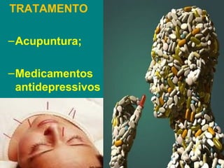 TRATAMENTO

– Acupuntura;

– Medicamentos
  antidepressivos
  .
 