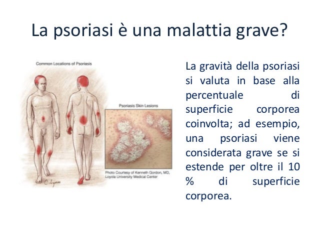 Eczema al bambino neonato