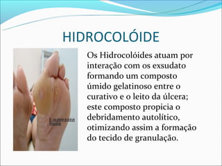 HIDROCOLÓIDE
       Os Hidrocolóides atuam por
       interação com os exsudato
      formando um composto
       úmido gelatinoso entre o
       curativo e o leito da úlcera;
       este composto propicia o
       debridamento autolítico,
       otimizando assim a formação
       do tecido de granulação.
 