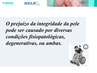 O prejuízo da integridade da pele
pode ser causado por diversas
condições fisiopatológicas,
degenerativas, ou ambas.
 