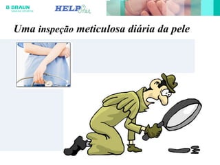 Uma inspeção meticulosa diária da pele
 