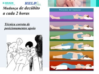 Mudança de decúbito
a cada 2 horas
Técnica correta de
posicionamentos apoio
 