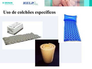 Uso de colchões específicos
 