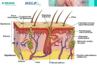 Hipoderme
 