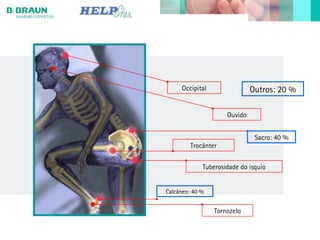 Occipital
Ouvido
Sacro: 40 %
Trocânter
Tuberosidade do ísquio
Calcâneo: 40 %
Tornozelo
Outros: 20 %
 