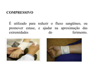 COMPRESSIVO


 É utilizado para reduzir o fluxo sangüíneo, ou
 promover estase, e ajudar na aproximação das
 extremidades            do           ferimento.
 