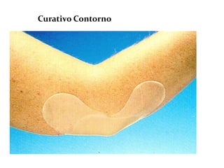 Curativo Contorno
 