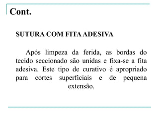 Cont.
SUTURA COM FITAADESIVA
Após limpeza da ferida, as bordas do
tecido seccionado são unidas e fixa-se a fita
adesiva. Este tipo de curativo é apropriado
para cortes superficiais e de pequena
extensão.
 