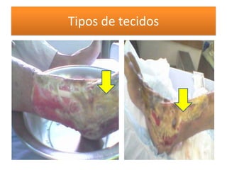 Tipos de tecidos
 