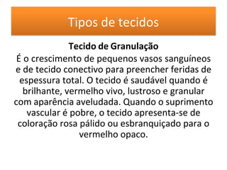 Tipos de tecidos
Tecido de Granulação
É o crescimento de pequenos vasos sanguíneos
e de tecido conectivo para preencher feridas de
espessura total. O tecido é saudável quando é
brilhante, vermelho vivo, lustroso e granular
com aparência aveludada. Quando o suprimento
vascular é pobre, o tecido apresenta-se de
coloração rosa pálido ou esbranquiçado para o
vermelho opaco.
 