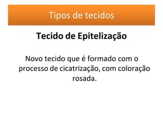 Tecido de Epitelização
Novo tecido que é formado com o
processo de cicatrização, com coloração
rosada.
Tipos de tecidos
 
