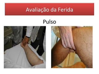 Avaliação da Ferida
Pulso
 
