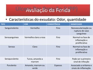 • Características do exsudato: Odor, quantidade
TIPO COR CONSISTÊNCIA SIGNIFICADO
Sanguinolento Vermelho Fino Neovascularização ou
ruptura de vaso
sanguíneo
Serosanguíneo Vermelho claro a rosa Fino Normal na fase de
inflamação e
proliferativa
Seroso Clara Fino Normal na fase de
inflamação e
proliferativa
Seropurulento Turvo, amarelo a
marrom
Fino Pode ser o primeiro
sinal de infecção
Purulento Amarelo, marrom ou
verde
Espesso Associado a eritema e
sinais de inflamação.
ÚlceA
ra
va
P
lio
ar
çã
P
o
re
ds
a
sã
Fe
ori(d
U
aPP)
 