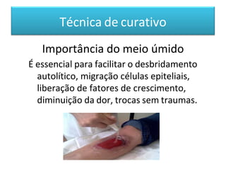 Técnica de curativo
Importância do meio úmido
É essencial para facilitar o desbridamento
autolítico, migração células epiteliais,
liberação de fatores de crescimento,
diminuição da dor, trocas sem traumas.
 