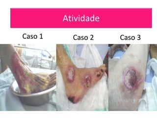 Caso 1 Caso 2 Caso 3
Atividade
 