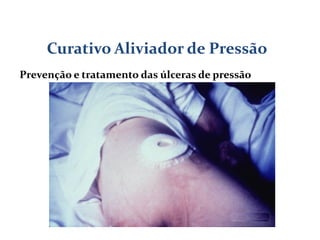 Curativo Aliviador de Pressão
Prevenção e tratamento das úlceras de pressão
 