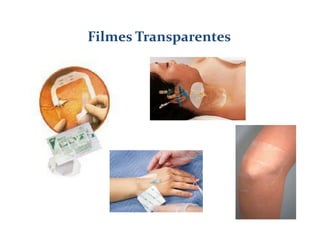 Filmes Transparentes
 