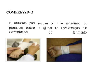 COMPRESSIVO
É utilizado para
promover estase,
extremidades
reduzir o fluxo sangüíneo, ou
e ajudar
do
na aproximação das
ferimento.
 
