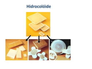 Hidrocolóide
 