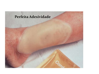 Perfeita Adesividade
 